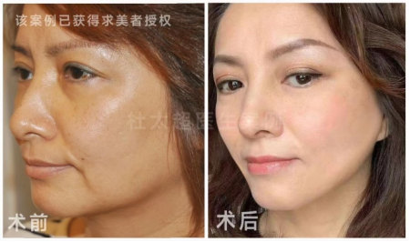 1696754406139889.jpg image.jpg