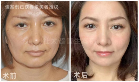 1696754421182213.jpg image.jpg