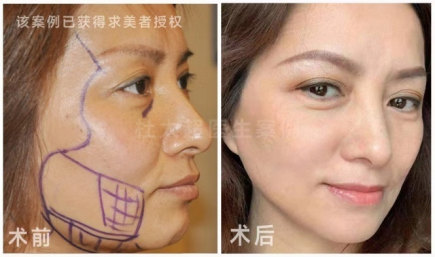 1696754436633386.jpg image.jpg