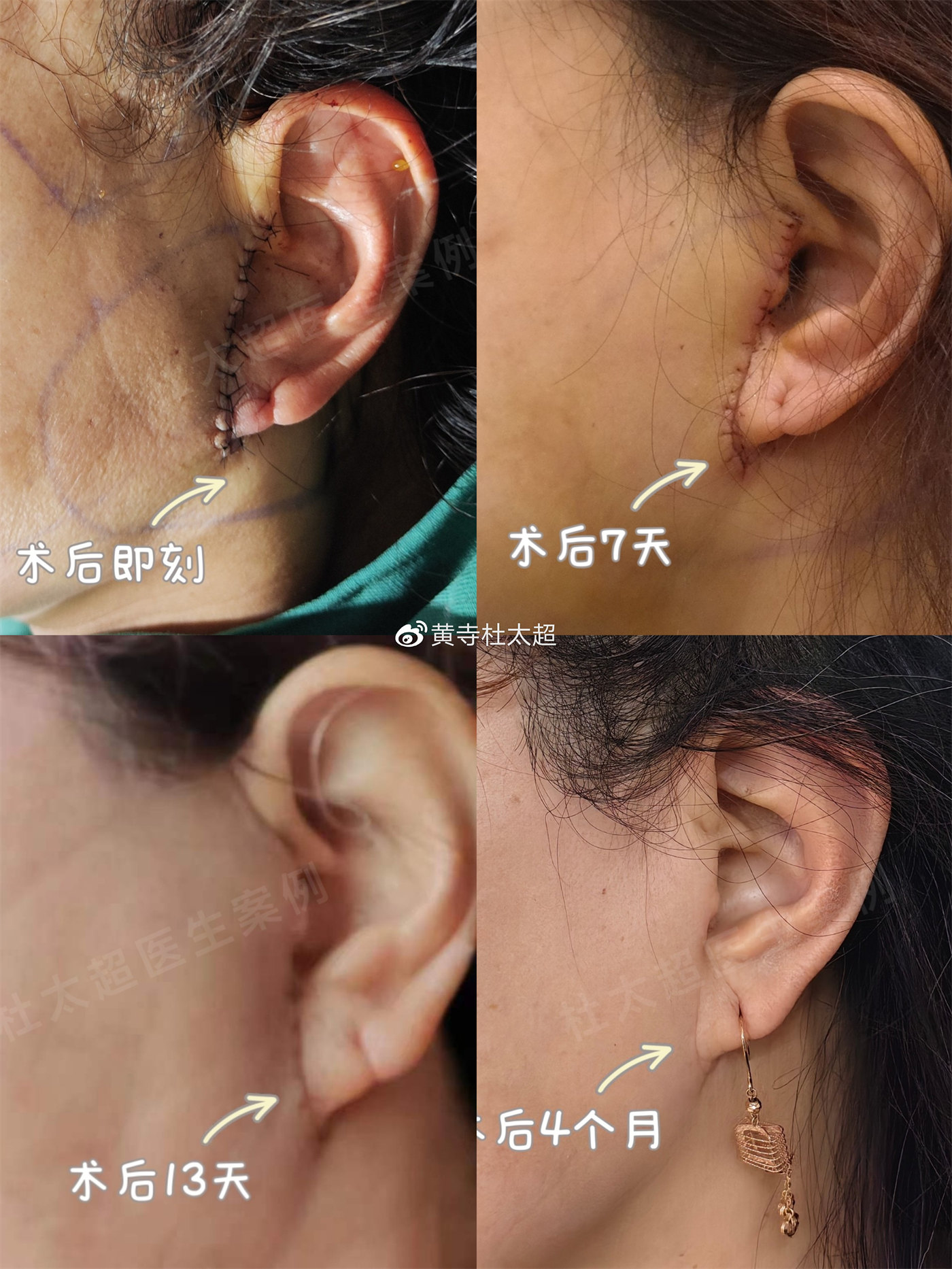 1696918971600657.jpg e9ff4f6f1a29372258a20e01c4e17ce3_6119e850ly1hdt6t1m3boj22dc35snph.jpg