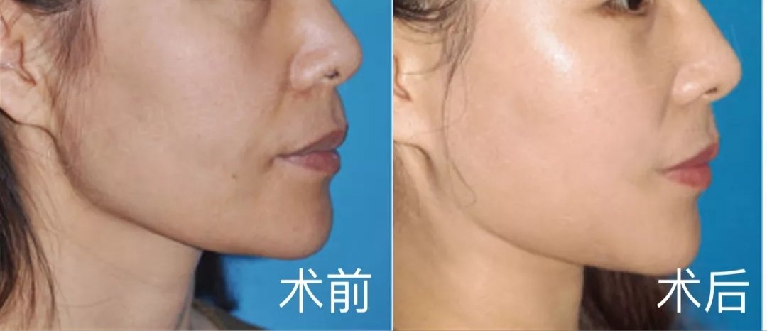 1697353671194718.jpg c7d98affdf3696a8b7e0e8ef9234ab46_1d24b0f2390ea366278b4f3bbd899aa2.jpg