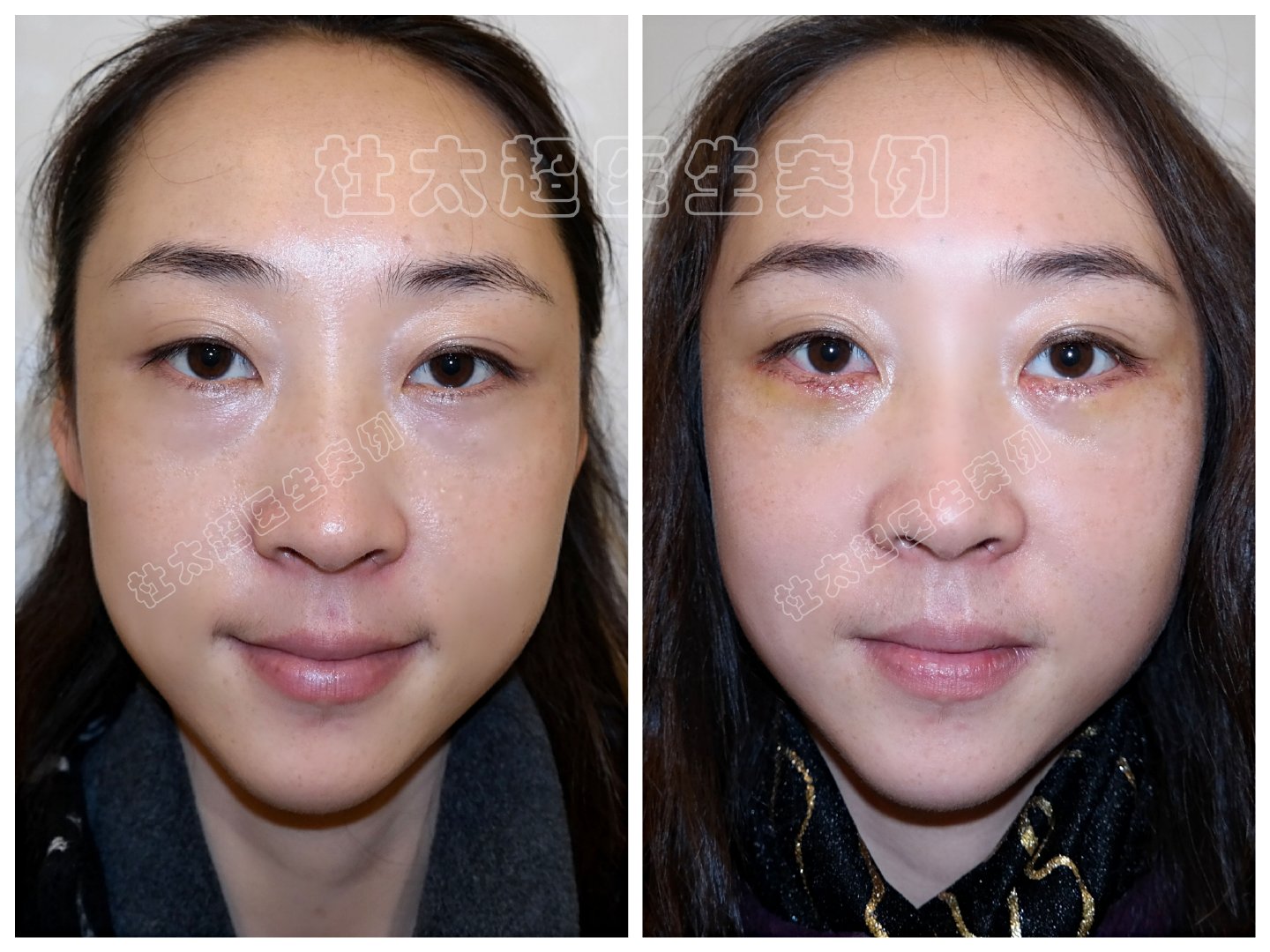 1697522269364550.jpg 3e68c24fde1b3b21cde25e916057af7a_0309ffd8c18a4420831618db6c973774.jpg