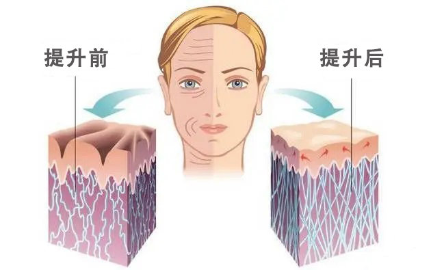 1697956427671736.jpg 39c8ac9f9264aa80f1a1e91029379318_1fa6fff9c6f5f90ccca6cb6de3a1adeb.jpg