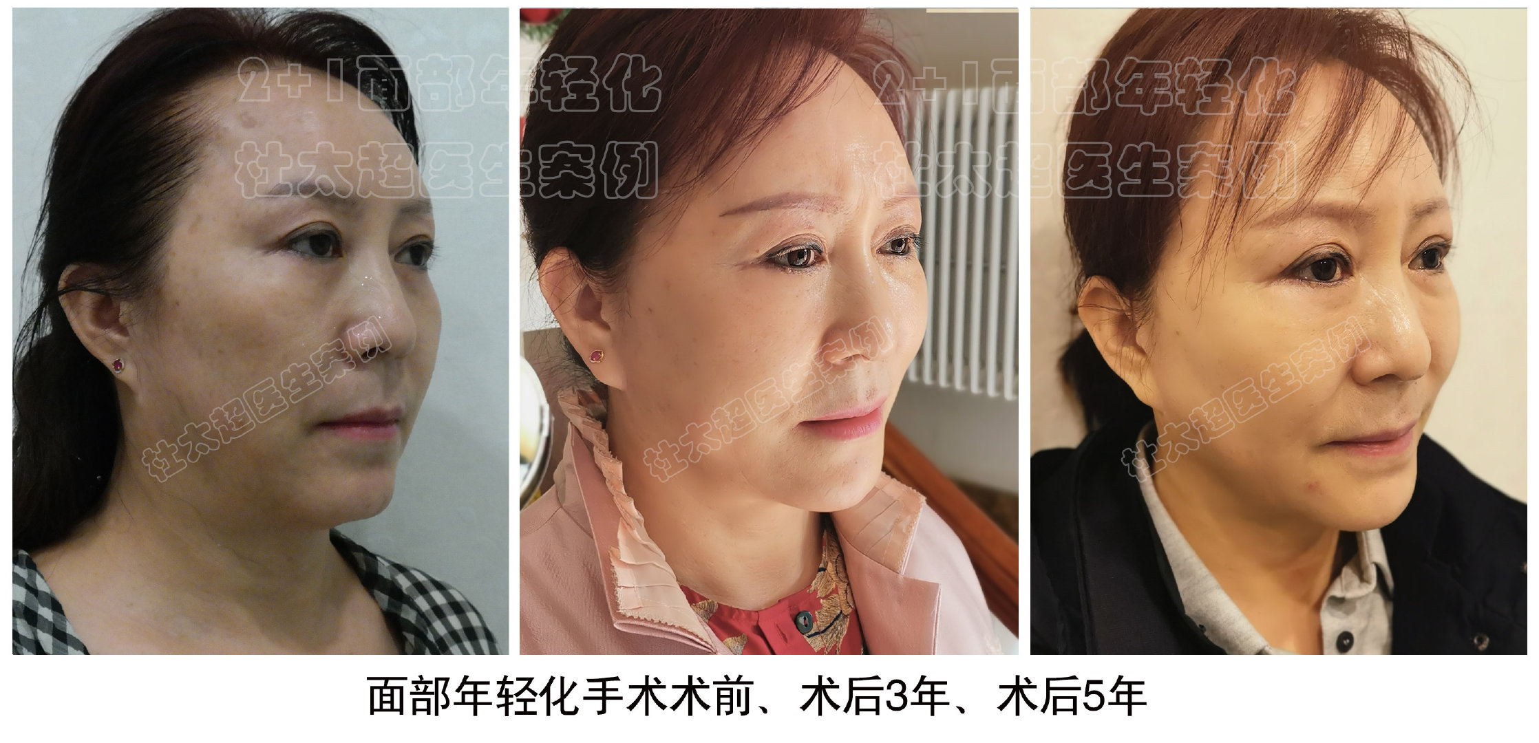 1697956493341901.jpg 24bf41828867f2ddb237a0a25f4e1b56_8b7413ff6b8c7c0bb9e43521078b9cd8.jpg