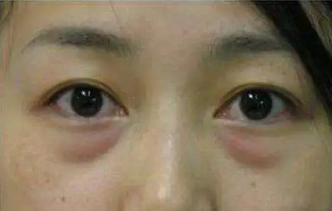 1698127114246109.jpg a51a7297d53aa43b0cc84e2a33c8f402_848eb71f6eeb96c570bc58e0a86d36be.jpg