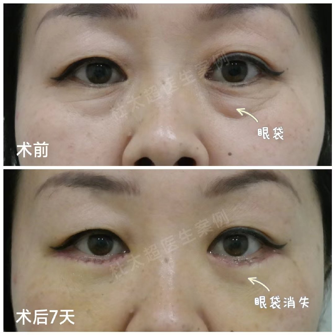 1698127143278178.jpg 2d2d965d9af035c481d4b590cd234441_7258ff1d97dd917b9f2bda95f5e85195.jpg