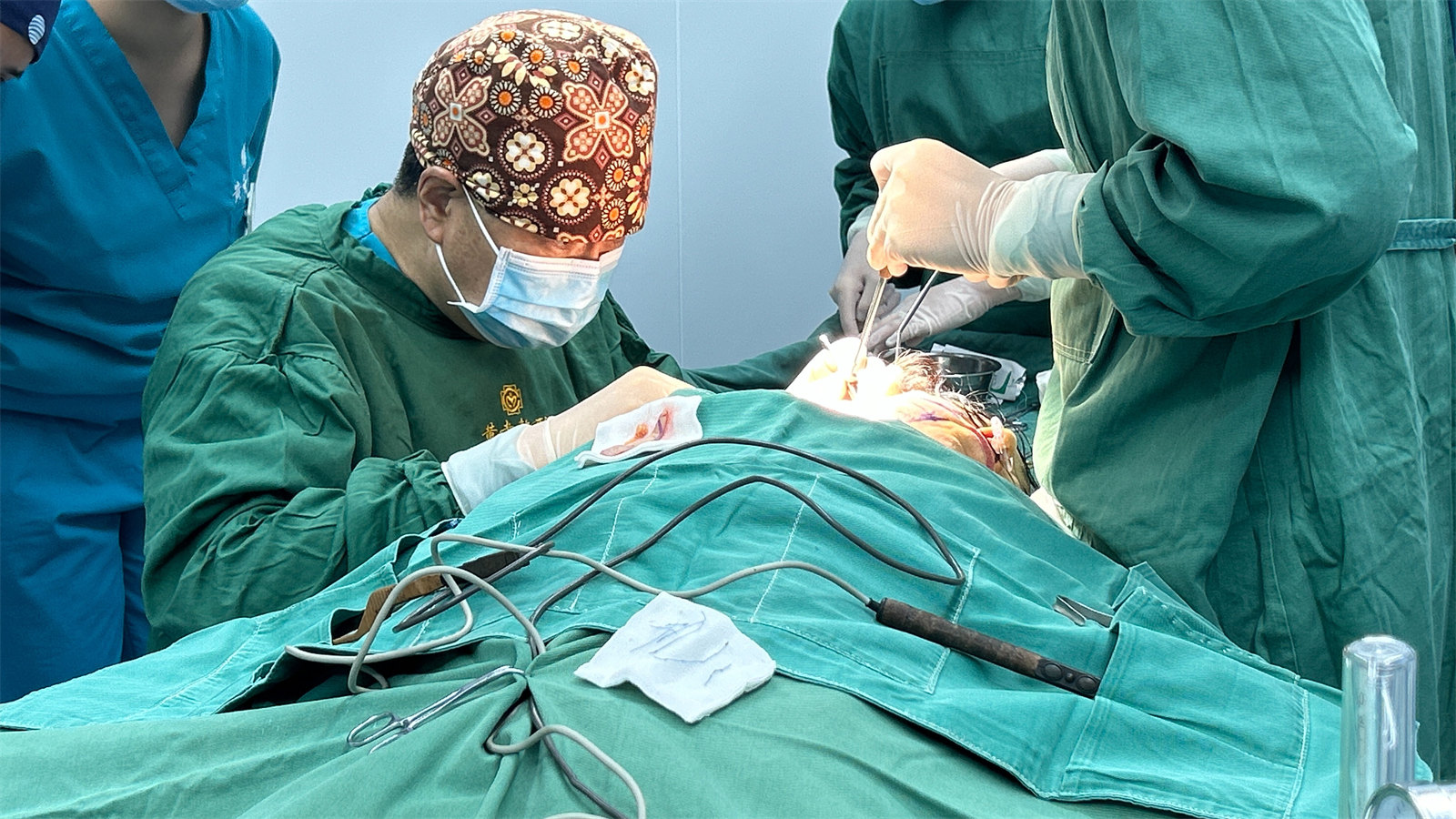 面部提升手术：太惊讶了！5年后她竟然还如此年轻！