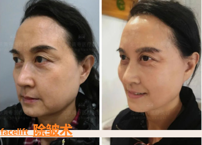 1699063836126871.jpg d5bab7fed112f9dfd5a03822e57e8186_975f9e83bc451fc17905f74dd154f431.jpg