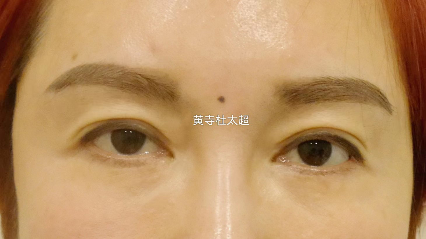 眼睛无神显老，是众多步入40岁大关女士的普遍问题，那么如何预防或者解决这种问题呢？