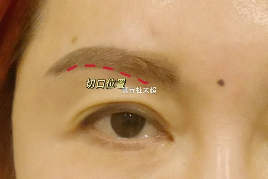 眼睛无神显老，是众多步入40岁大关女士的普遍问题，那么如何预防或者解决这种问题呢？