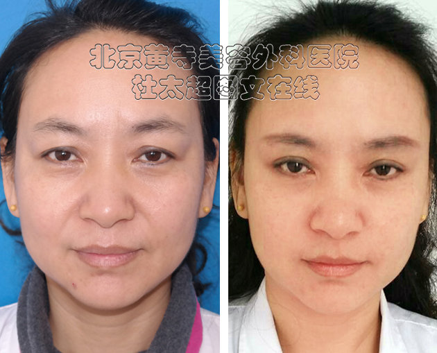 1699253488184075.jpg 1dac952f6f0d01f497d75056f78b034f_ebca9ea40192d661dc8e2cbb33ac8047.jpg