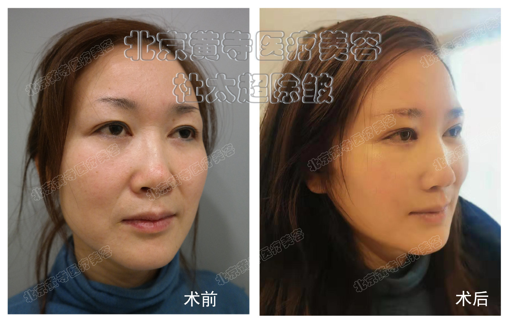 1699582810829648.jpg b22e79673bbe3c10d8162cbc6cd42474_0318b95608d1233f05590550d3fb7ce5.jpg