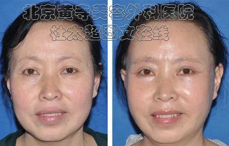 1699936276111192.jpg b1e942abb2e7b159571ccce7077c1ec3_7450a8ab47360569705ad4ce1585c459.jpg