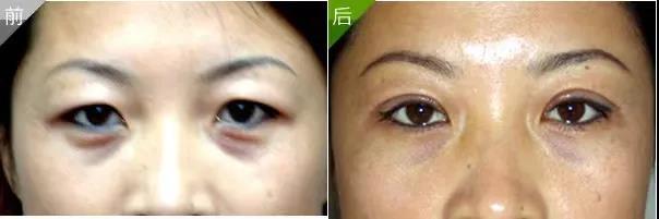 1700018738129818.jpg 5165bcd994a584b38ced121156efadfe_f429e67bf91d1e6e72b8d77adc37b6af.jpg