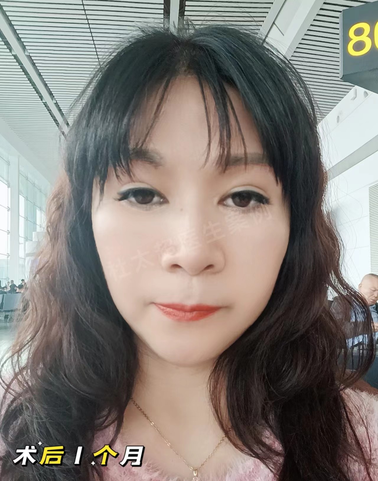 58岁追求青春容颜，不惜做了拉皮手术，没白遭罪！