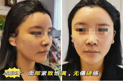 1702895652301400.jpg image.jpg