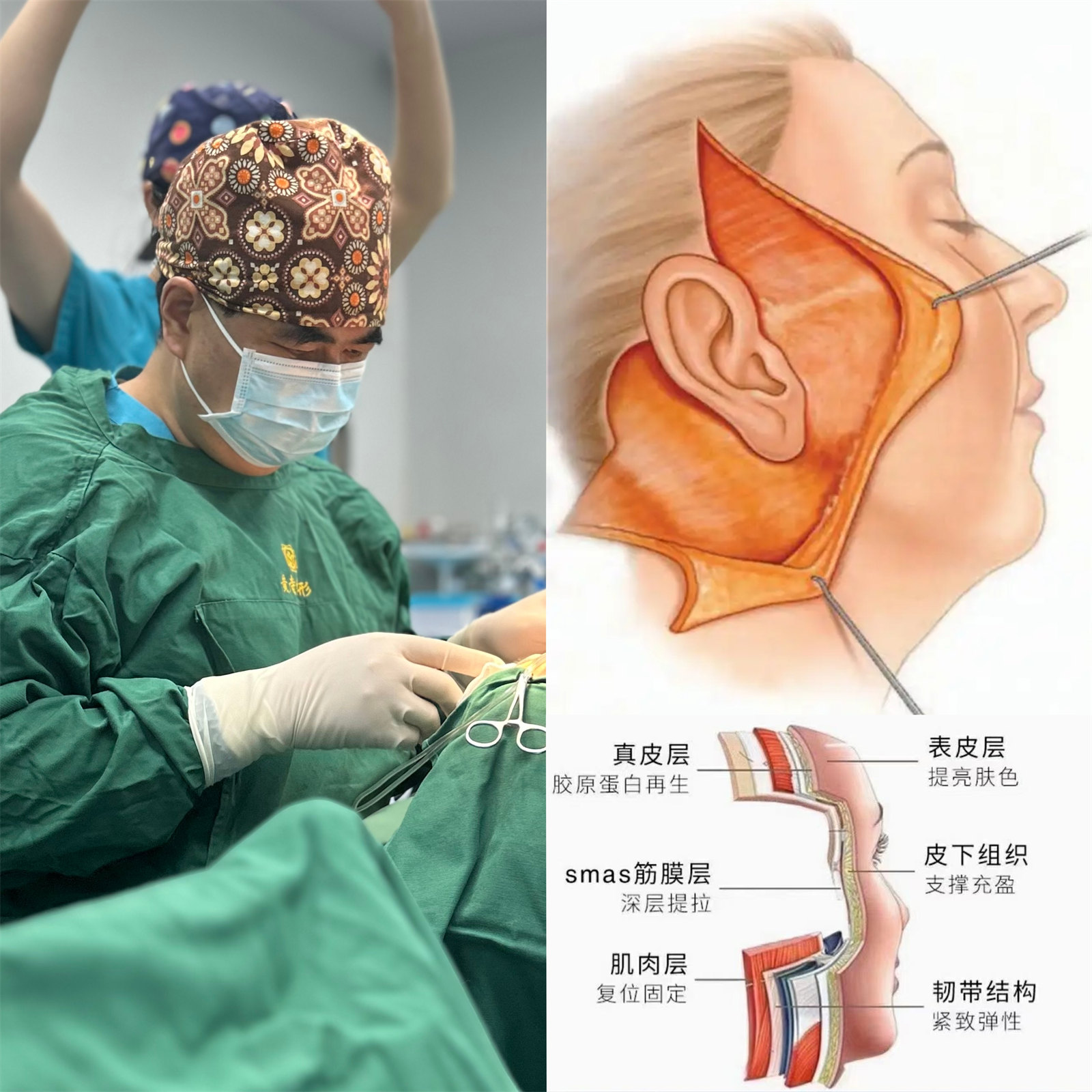 54岁求美者，为了变美奔赴北京做了拉皮提升，自己都被惊艳到