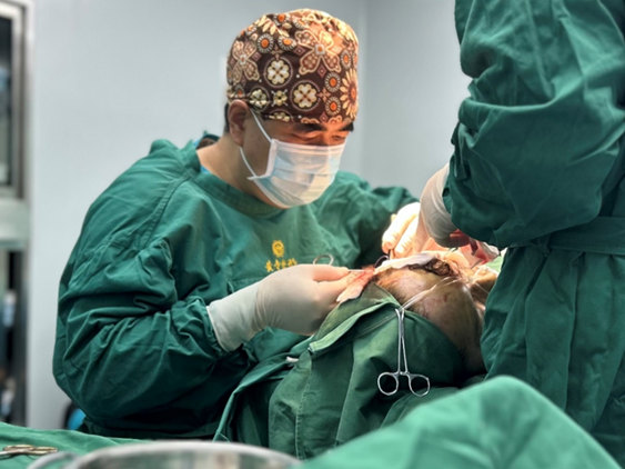 爱美不分年龄，69岁阿姨挑战拉皮