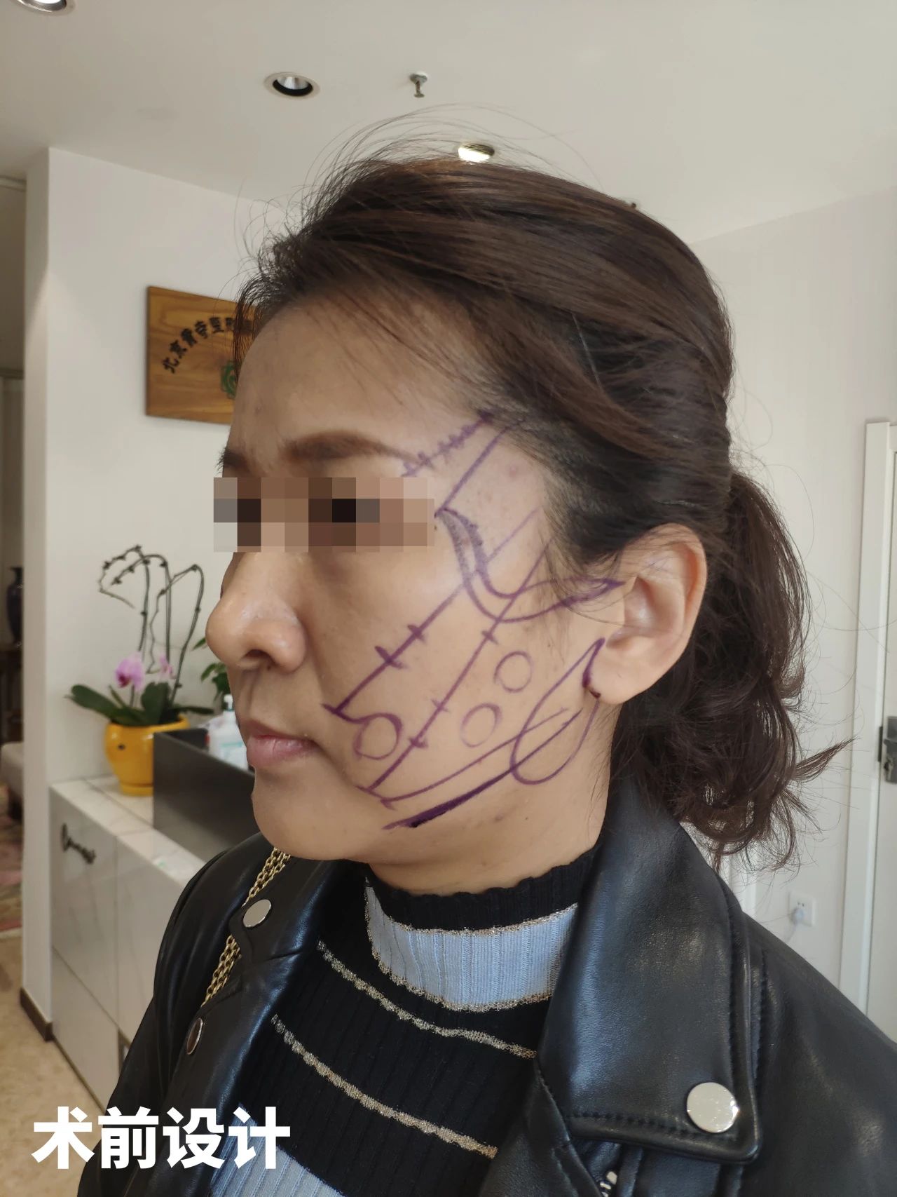 回眸手术前那些担惊受怕的日子，不禁哑然失笑，原来一切都是多余的担忧，真的就是“白担心一场”！