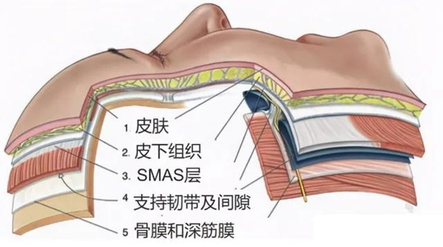 很多求美者问:面部提升手术的剥离范围来说是不是越大越好呢? 很多求美者问:面部提升手术的剥离范围来说是不是越大越好呢?