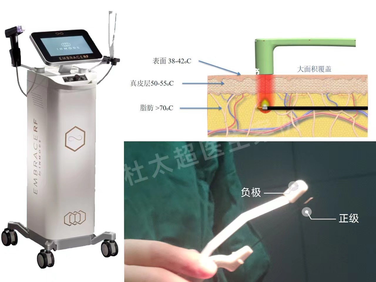 55岁追求年轻，做了拉皮手术，分享术后效果