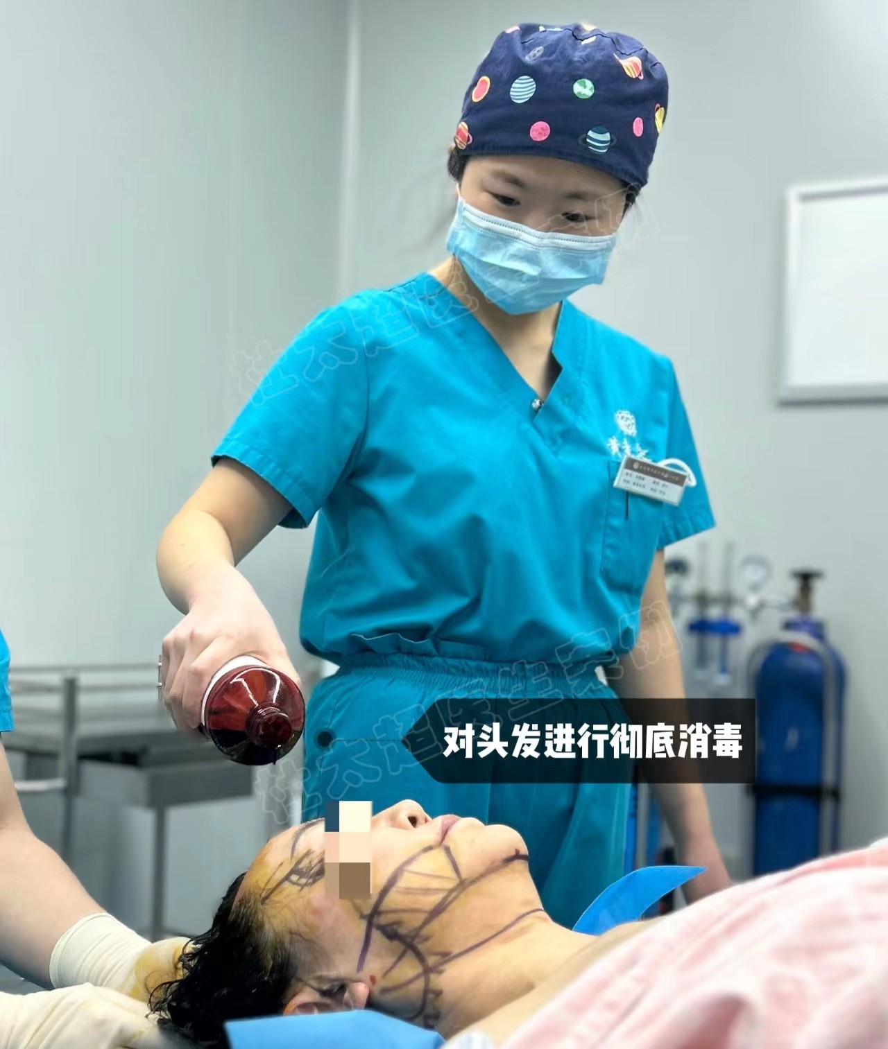 54岁豁出去做大拉皮，公开手术过程