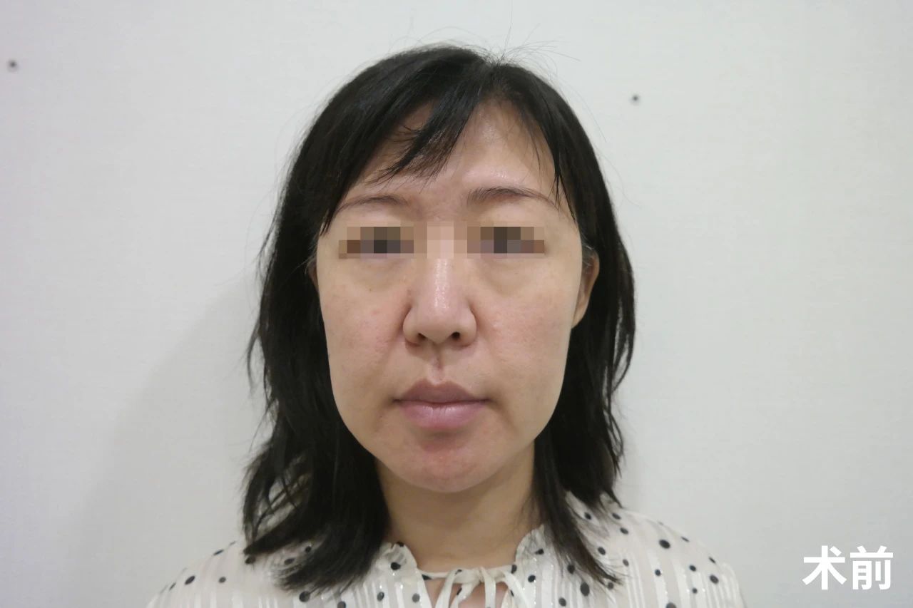 每一次的选择，每一次的改变，都让我离理想中的年轻态更近一步，而这一切，都源于我对美丽那份执着且快乐的追求。