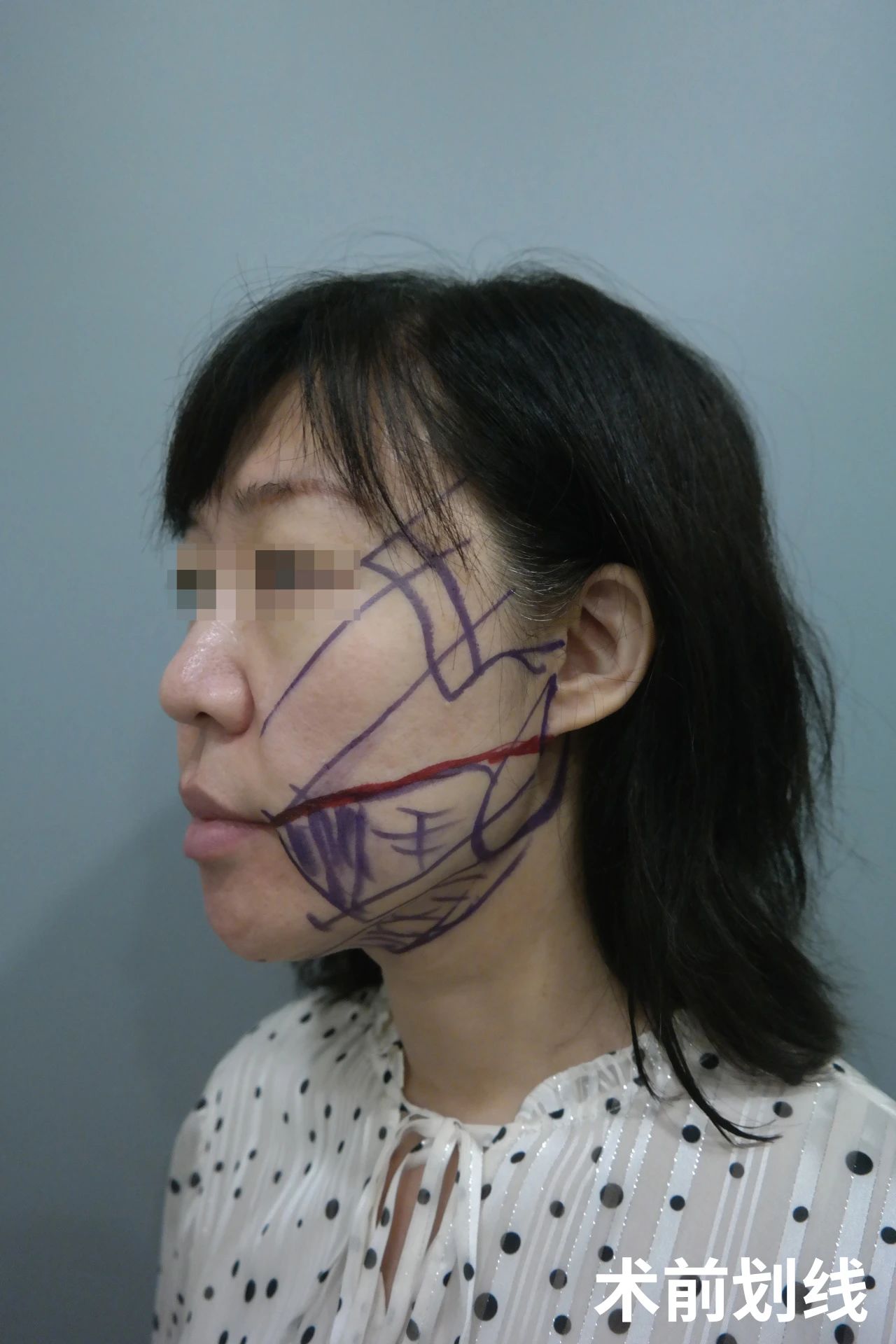 每一次的选择，每一次的改变，都让我离理想中的年轻态更近一步，而这一切，都源于我对美丽那份执着且快乐的追求。