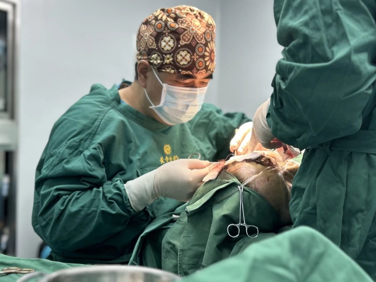 53岁，拉皮手术半年真实记录，脸大变样，效果惊呆了！