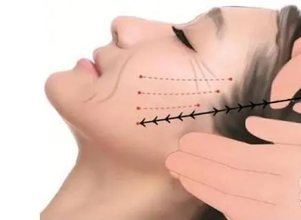 整形医生提醒你，40岁以后，这3个项目就别做了！