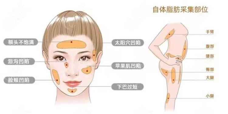 整形医生提醒你，40岁以后，这3个项目就别做了！