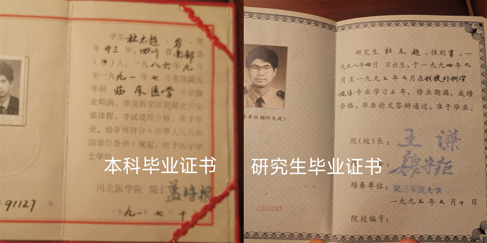 杜太超拉皮手术价格贵吗？