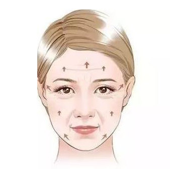 揭秘拉皮手术剥离范围，是不是越大越好？