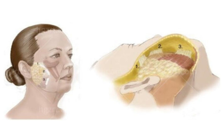 拉皮手术为什么会失败，以下几点你了解吗？