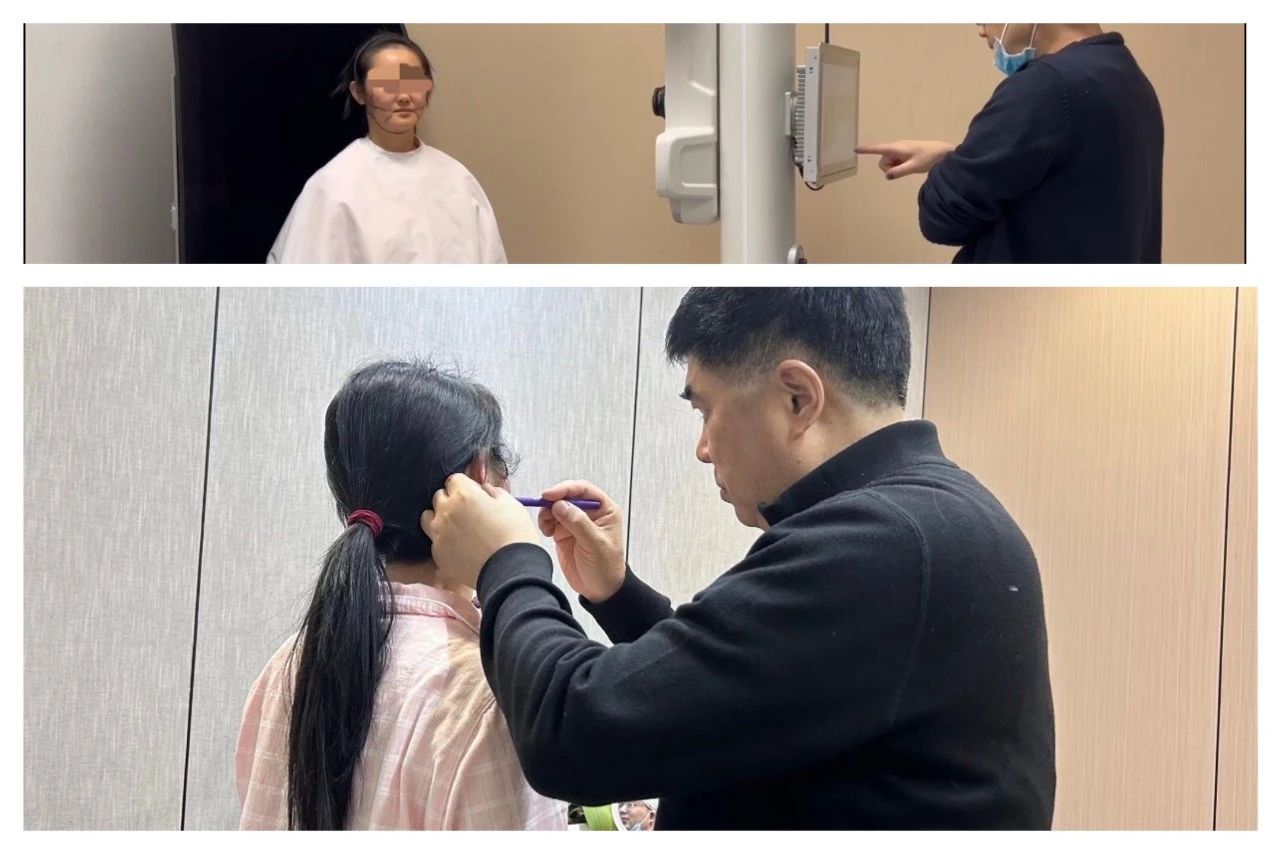 45岁，害怕国外医生，回国寻找青春——术后8天内心独白！