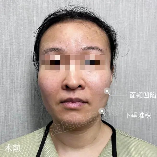 我不希望改变太大,我害怕别人的嘲笑! 我不希望改变太大,我害怕别人的嘲笑!