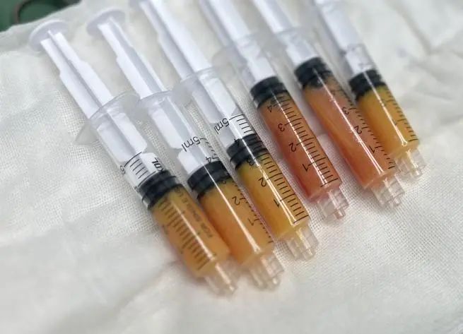 拉皮手术哪家好？重获青春：我的美丽改变之旅！