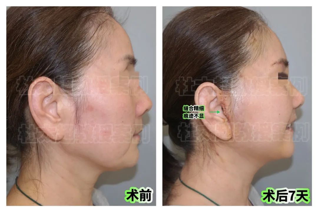 为婚礼拉皮，60岁阿姨太拼了！这样的年轻化你们看值吗？