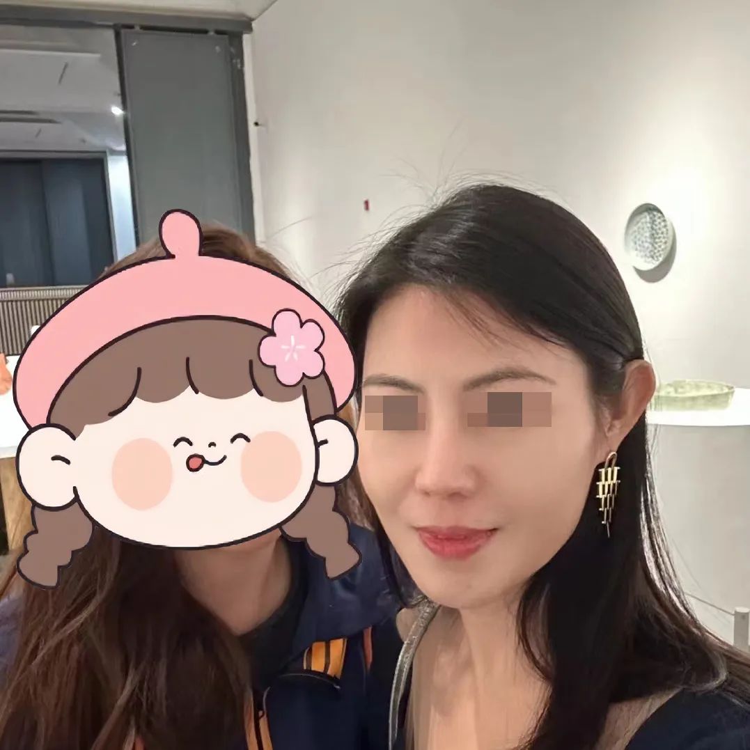 39女设计师个性化重塑之旅，从隆鼻到拉皮她总共做了几步？