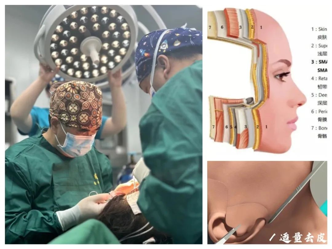 从‘岁月老葱’到‘时光嫩宠’，你到底通过拉皮手术干了什么！