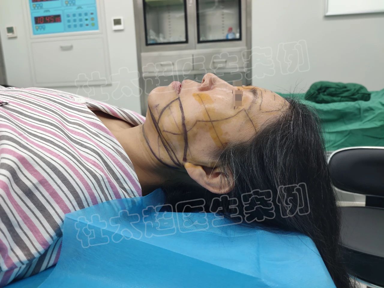 超震惊！50岁大妈拉皮后，秒变20岁少女？大伙直呼“逆天改命”！