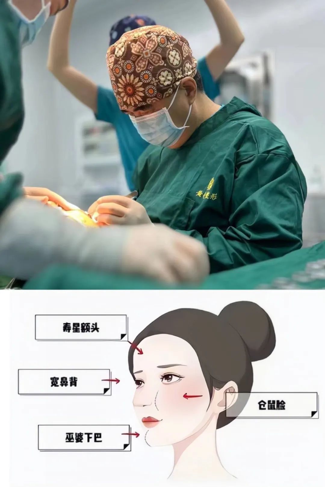 “充气脸”、“馒化脸”不存在的！caw小切口面部提升全过程大曝光！