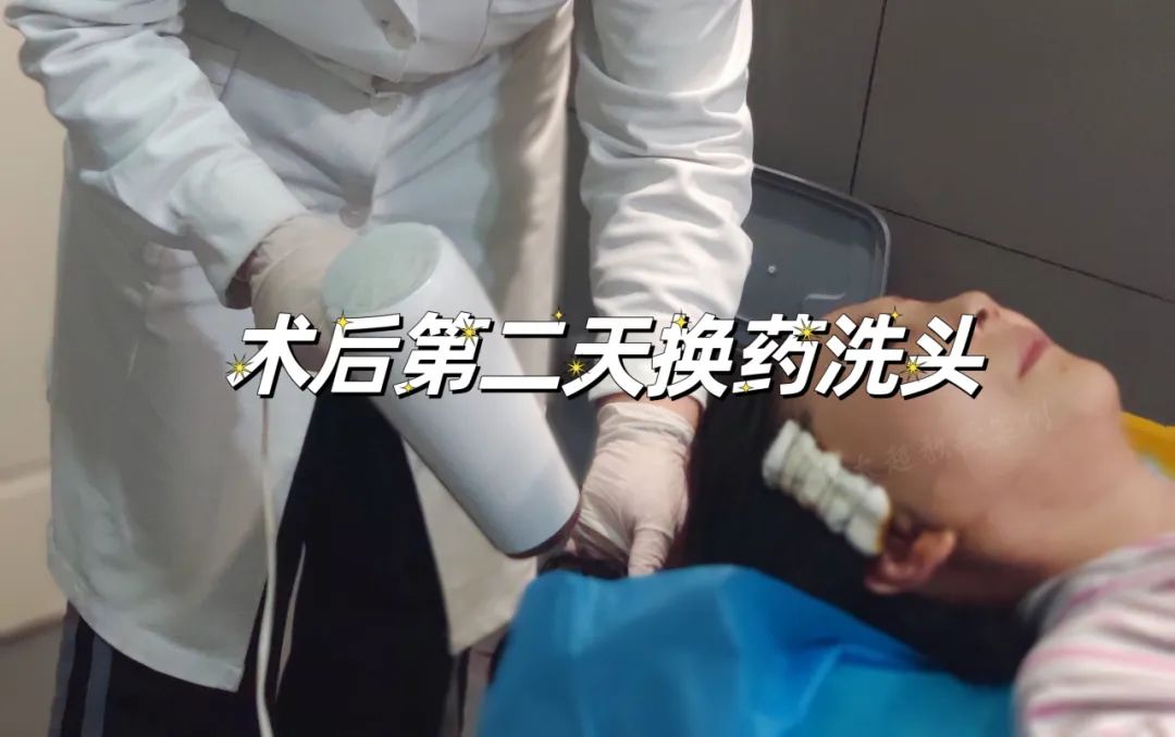 拉皮手术怎么样？医生也疯狂追美？48岁体验拉皮奇迹，效果意想不到！