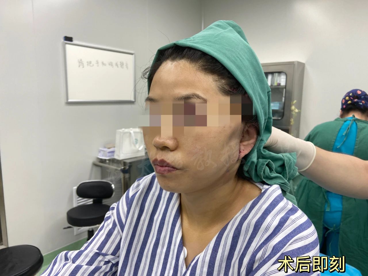 她说太丑！拉皮手术到底给她带来了什么，想要惊艳时光是痴心妄想？