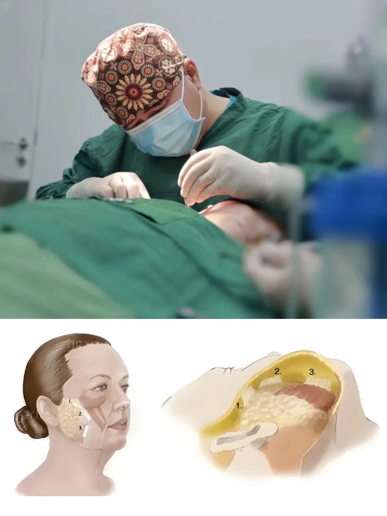 拉皮手术哪里做的最好? 拉皮手术哪里做的最好?