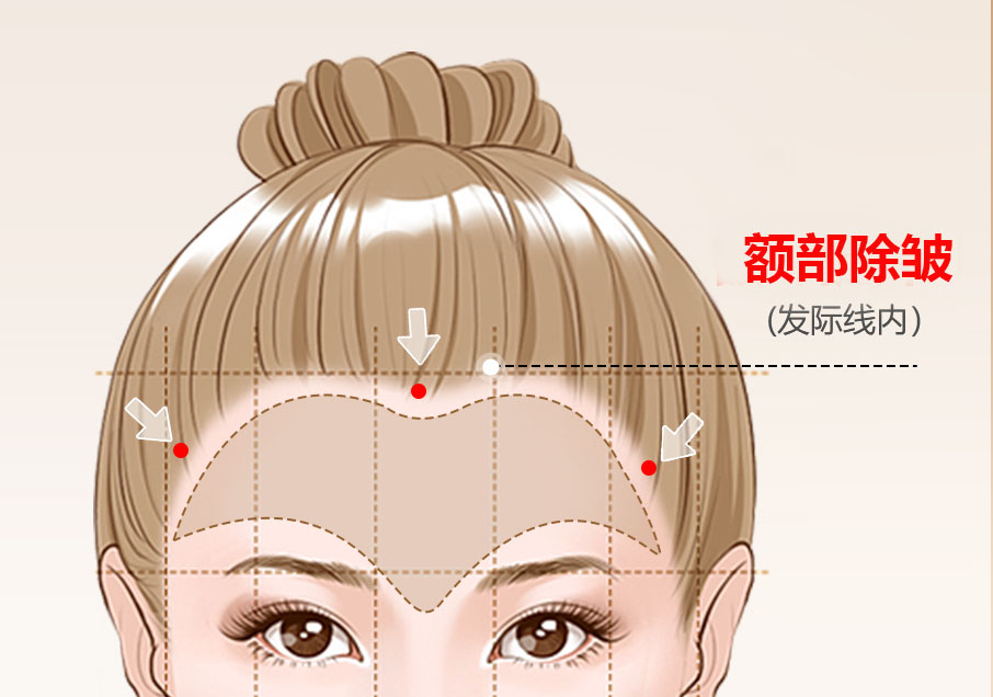 额部除皱和额部拉皮是一回事吗？专业解答来了