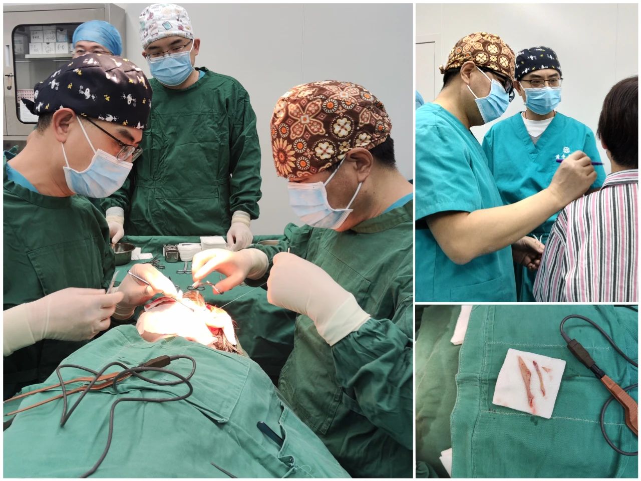 拉皮手术效果这么好？54岁女士为何选择杜太超教授手中重获年轻？