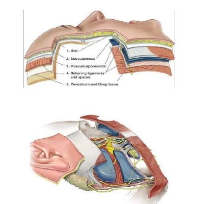 拉皮手术为什么会失败? 拉皮手术为什么会失败?