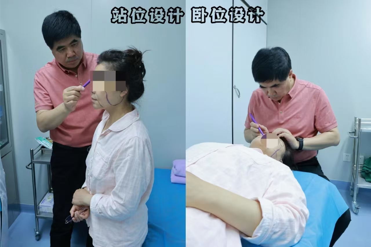 60岁深陷线雕漩涡，终于因为一次拉皮手术上岸