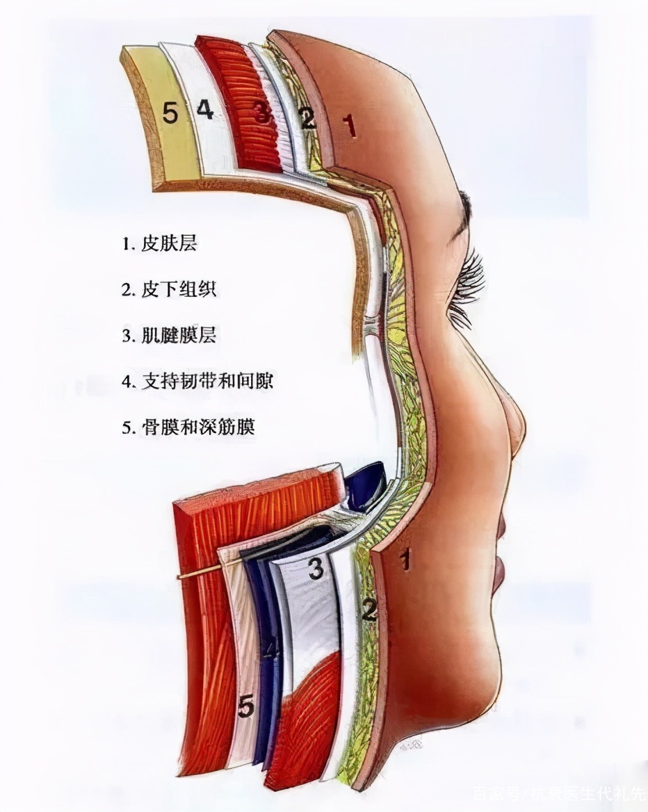 拉皮手术皮肤怎么剥离？能剥到哪里？